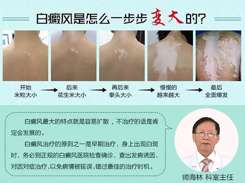 时代之光下的白癜风治疗革新之旅，最新治疗技术揭秘